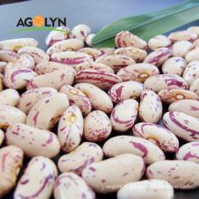 High quality Flower Kidney Beans with Vitamin B1and Iron